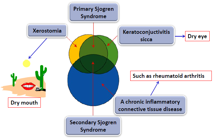 <ul><li><p>an autoimmune disease</p></li><li><p>affects the salivary and lacrimal glands</p><ul><li><p>typically leads to xerostomia</p></li><li><p>keratoconjunctivitis → dry eye</p></li><li><p>chronic inflammatory connective tissue disease → rheumatoid arthritis </p></li><li><p>raynaud phenomenon (white fingers) → triggered by cold and emotional stress </p></li></ul></li></ul><p></p>