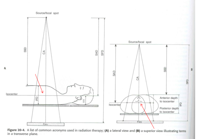 <p>The redlines on this diagram demonstrate the isocenter of this patient.</p>