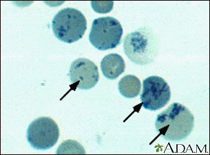 <p>Reticulocytes </p>