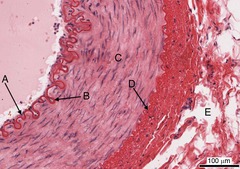 <p>The innermost layer of a blood vessel (A).</p>