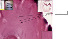 <p>What is the structure at 1</p>