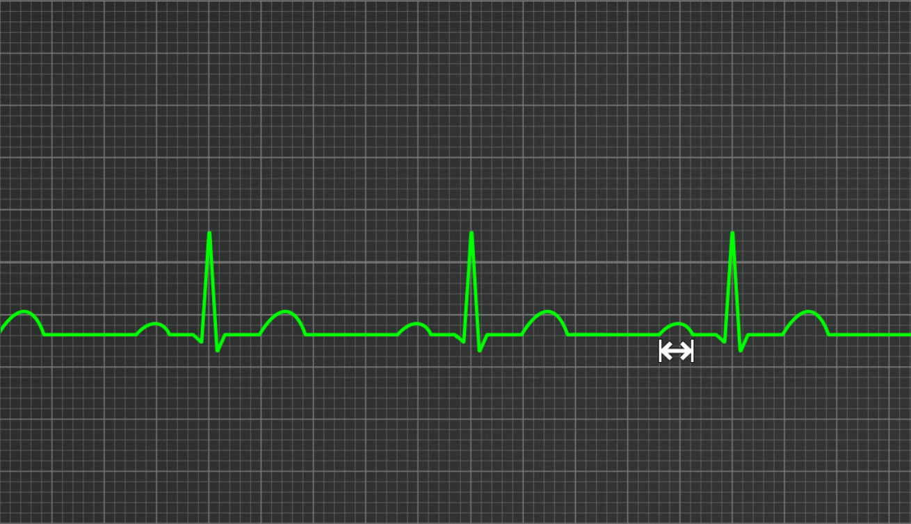 <p>What wave is this</p>