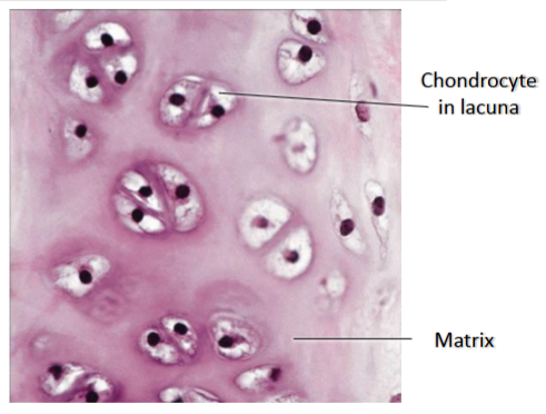 <p>Structure- glassy looking matrix, covered by perichondrium</p><p>Function- smooth joint surfaces, model for bone growth, supports soft tissues</p><p>Location- ends of long bones, costal cartilage, most of larynx, trachea, nose</p>