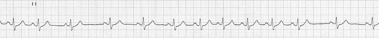 <p>What rhythm is this?</p>