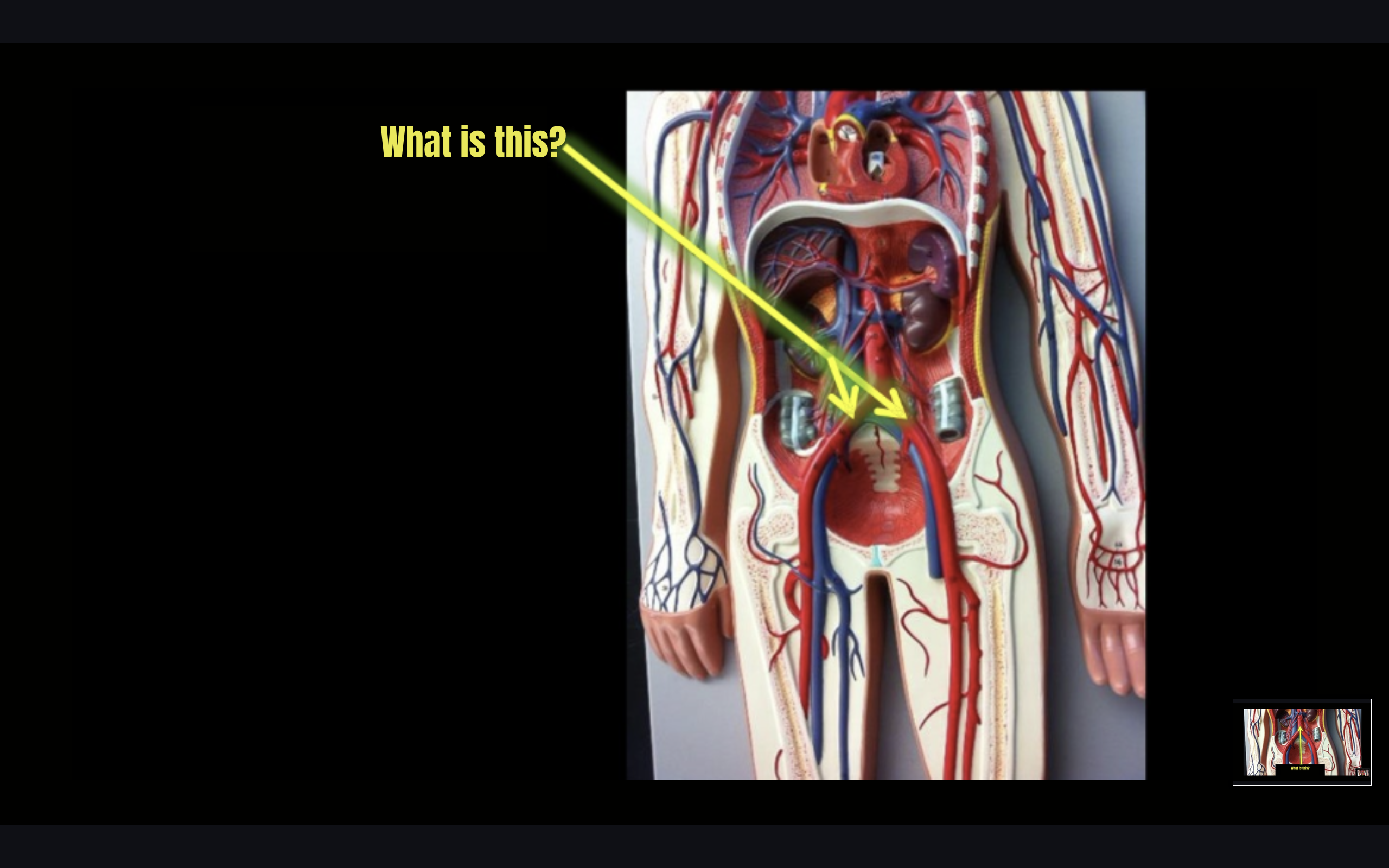 term image