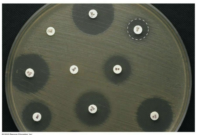 <p><strong><em>Standardizations</em></strong>:</p><ul><li><p>Size of the agar plate</p></li><li><p>Depth of the media</p></li><li><p>Media composition (no PABA)</p></li><li><p>The number of organisms (0.06 OD at 600 nm)</p></li><li><p>Size of the disks</p></li><li><p>Concentration of antibiotics in the disks</p></li><li><p>Incubation temperature</p></li></ul><p></p>