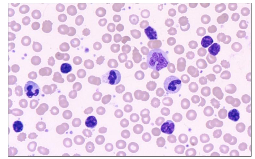 <p>Which of the cells in this image are neutrophils</p>