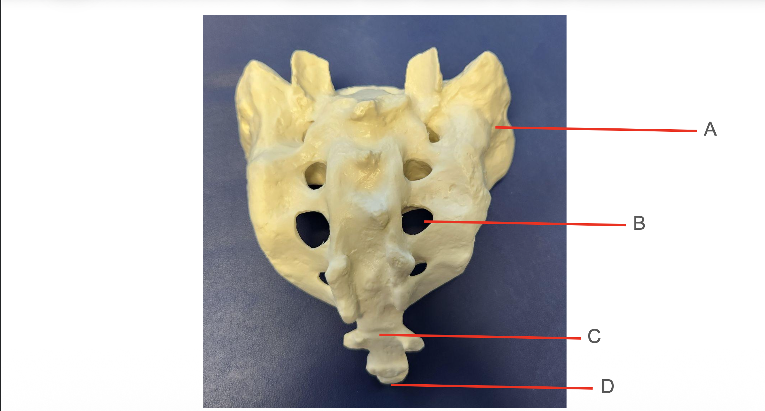 <p>Identify Structure A</p>