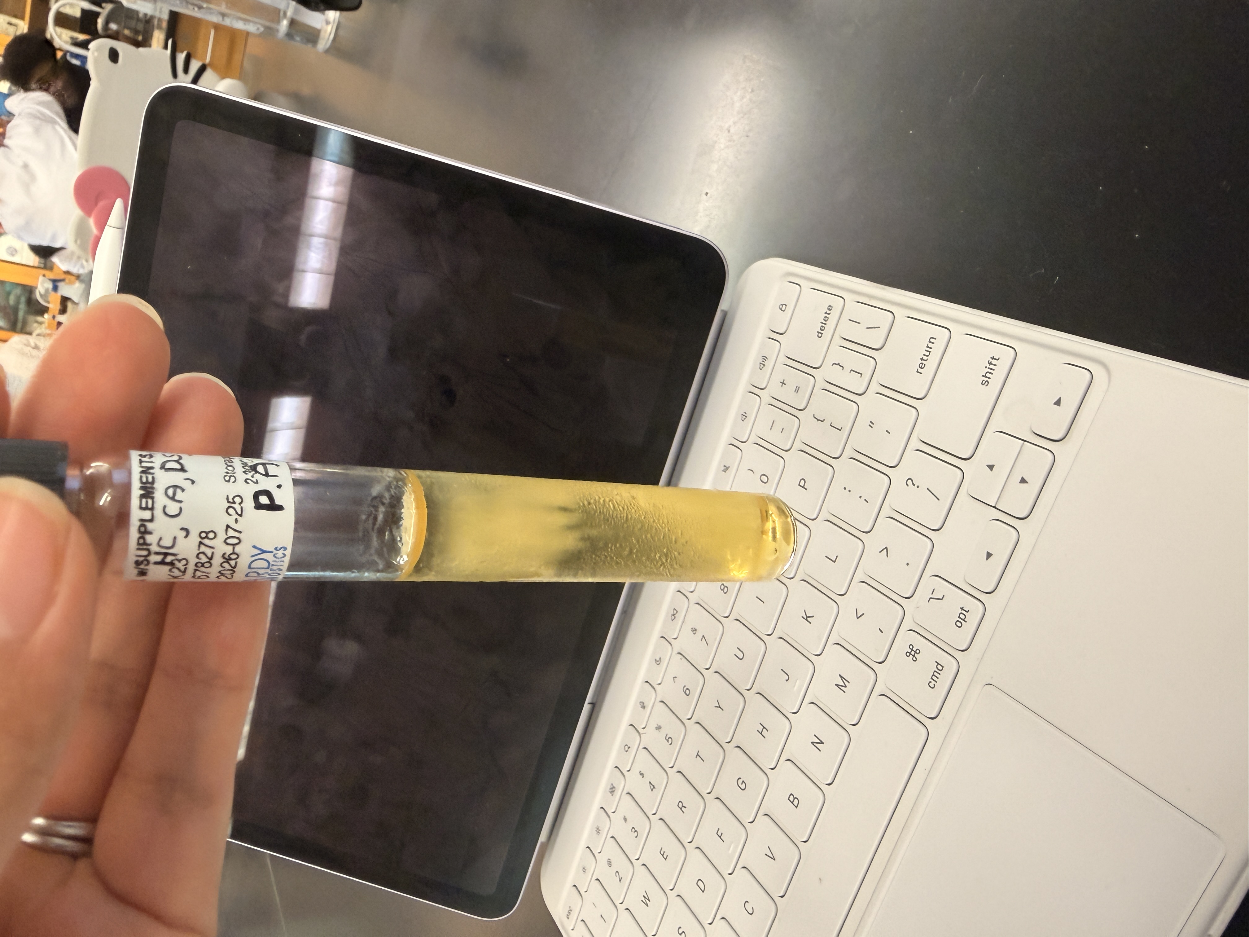 <p>P. Aeruginosa </p>