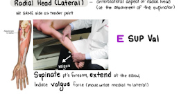 <p>E Sup Val</p>