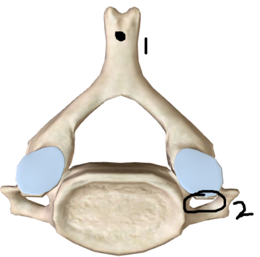 <p>What type of vertebrae is this? Identify each point</p>