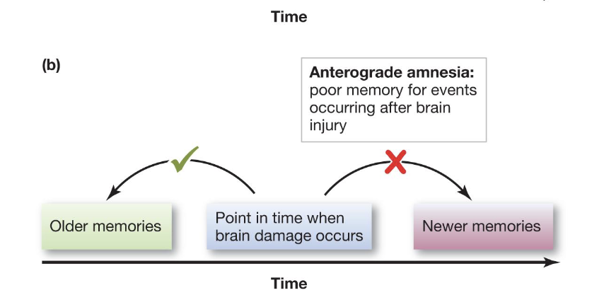 <p>Poor memory for events occurring AFTER the brain injury </p>