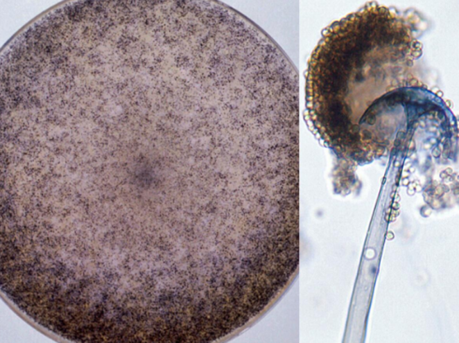 <p>Identify this fungus</p>