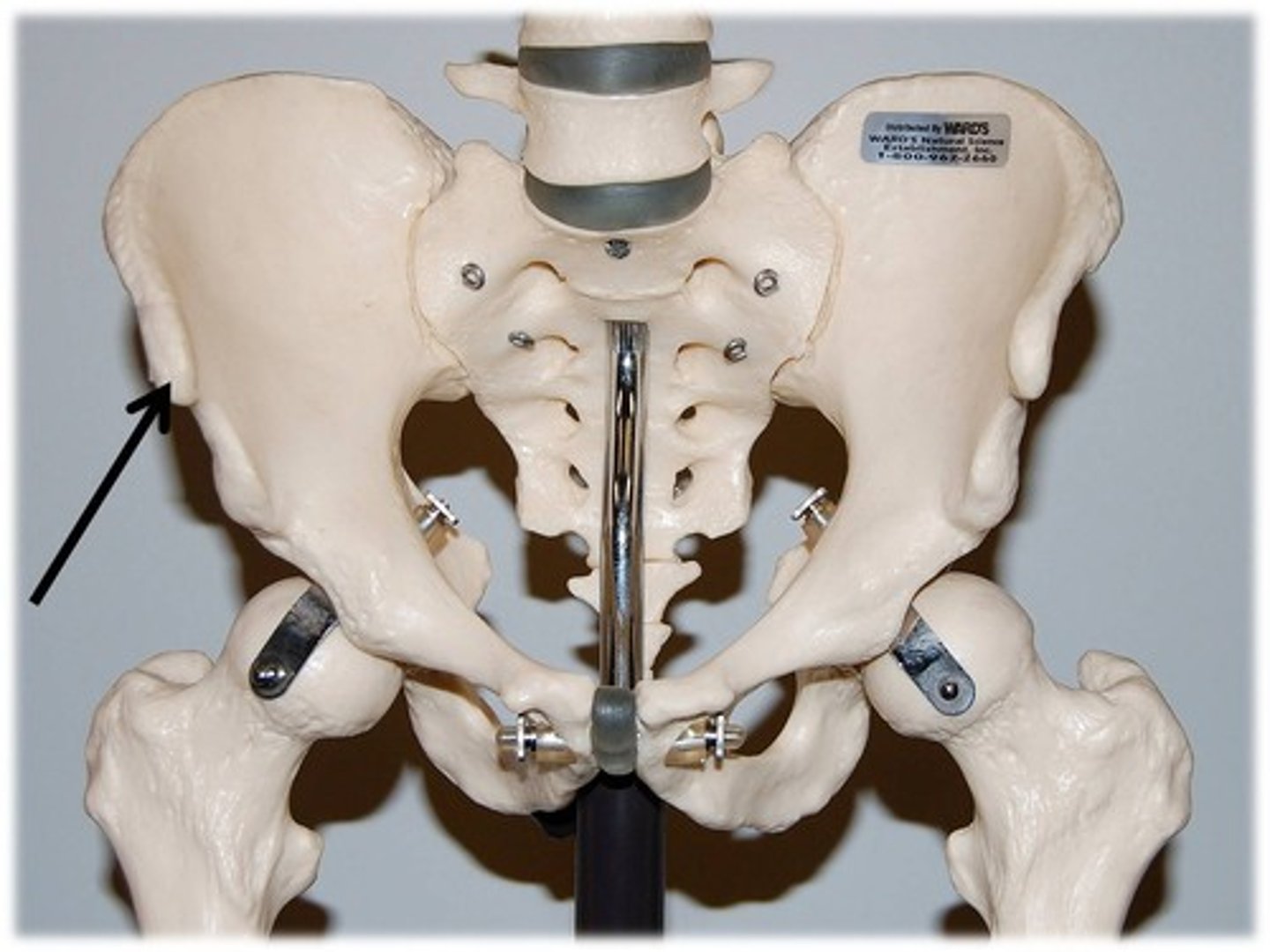 <p>Name this specific part of the pelvic bone.</p>