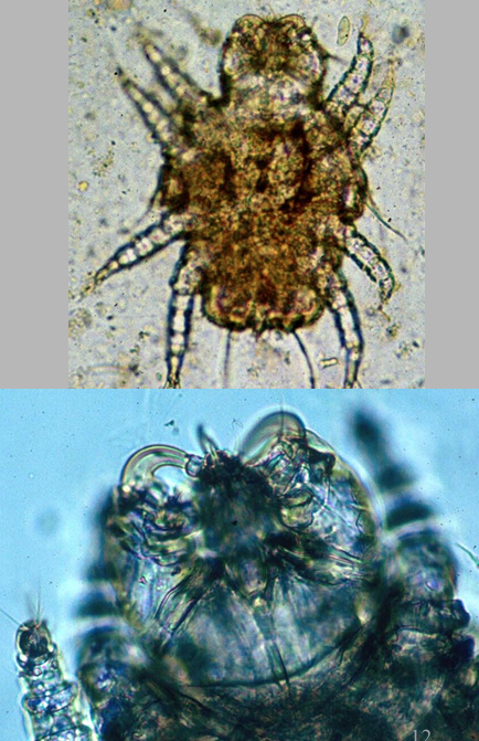 <p>Walking Dandruff mite</p>