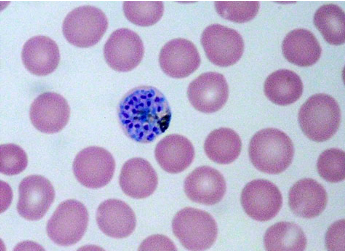 <p>Patient with cyclic fever/chills after travel to Mexico + blood smear showing intraerythrocytic ring forms/schizonts -> Vector and causal genus?</p>
