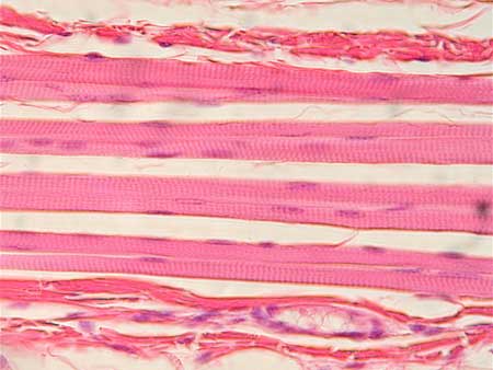 <p>Distinguish the muscle tissue:</p>