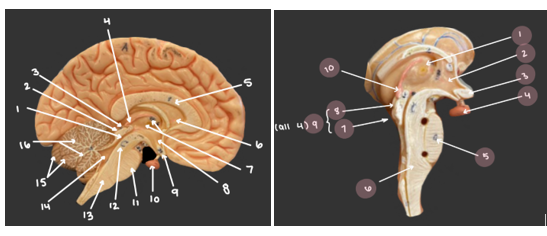 <p>#10 (left) and #4 (right)</p>