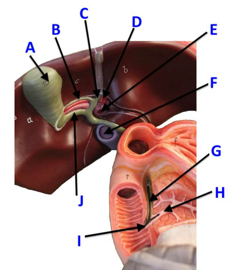 <p>A</p>