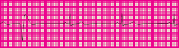 <p>Which rhythm is this?</p>