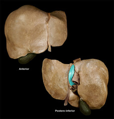 <p>Identify the structure</p>