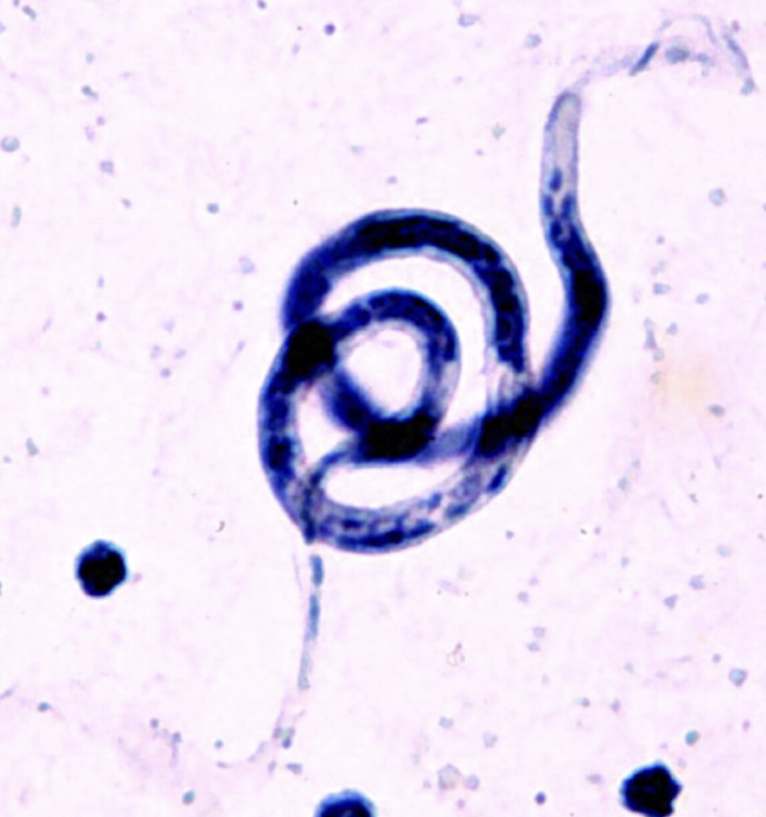 <p>What parasite is this?</p>