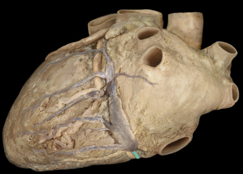 <p>Identify the coronary vein</p>