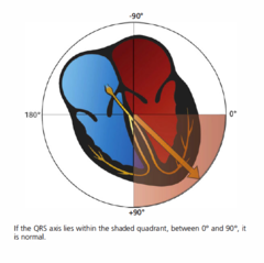 <p>normally points DOWNWARD & to the patient's LEFT due to depolarizations of the LEFT VENTRICLE</p>