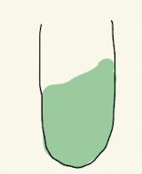 <p>Citrate → no growth</p>