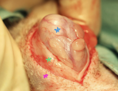 <p>What is the blue star?</p>