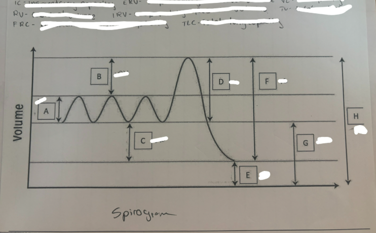 <p>Lung Spiriogram</p>