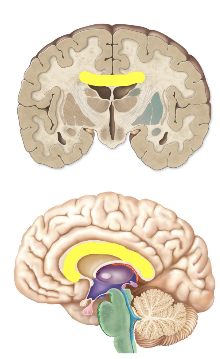 <p>Corpus Callosum</p>