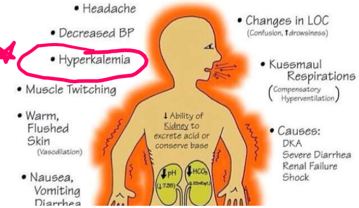 <p>What condition is displayed by signs and symptoms shown here?</p>