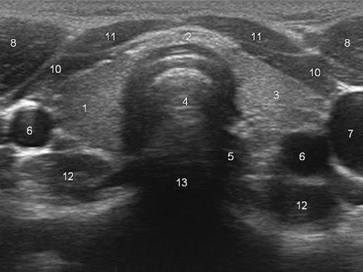 <p>Name the locations on this image</p>