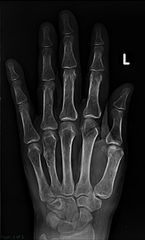 <p>What makes a good hand X-ray?</p>