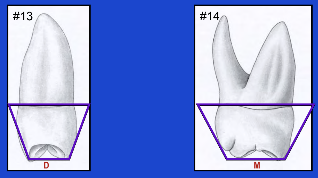 <p>From the proximal aspect, the longer of the parallel sides will be </p>