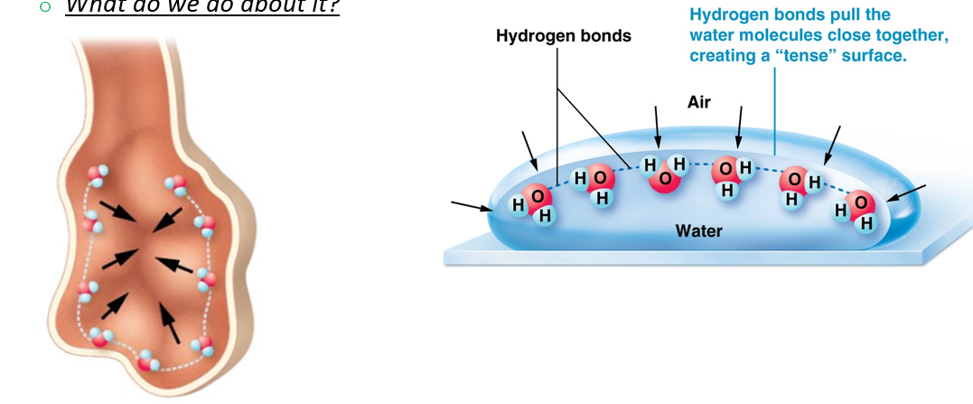<p>Alveoli are covered with a thin film of liquid composed mainly of water, creating a gas-water boundary.</p><ul><li><p>Factor of pulmonary ventilation effectiveness</p></li><li><p>A gas-water boundary exists within each alveolus because water molecules form hydrogen bonds with each other </p><ul><li><p>Creates surface tension</p><ul><li><p>Makes alveoli tend to collapse (opposite walls start to cling to one another) if surface tension is not reduced</p></li></ul></li></ul></li><li><p>Managed by surfactant chemical released by type II alveolar cells</p></li></ul><p></p>