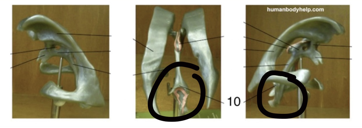 <p>Location: Midline, more towards the bottom; Function: Sends CSF to spinal cord</p>