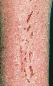 term image