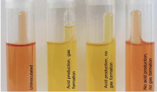 <p><u>Left:</u> Uninoculated</p><p><u>2nd from Left:</u> Acid production (color change to yellow), gas formation (bubble in Durham Tube)</p><p><u>3rd from Left:</u> Acid production, no gas fermentation </p><p><u>Right:</u> No acid production, no gas formation </p>