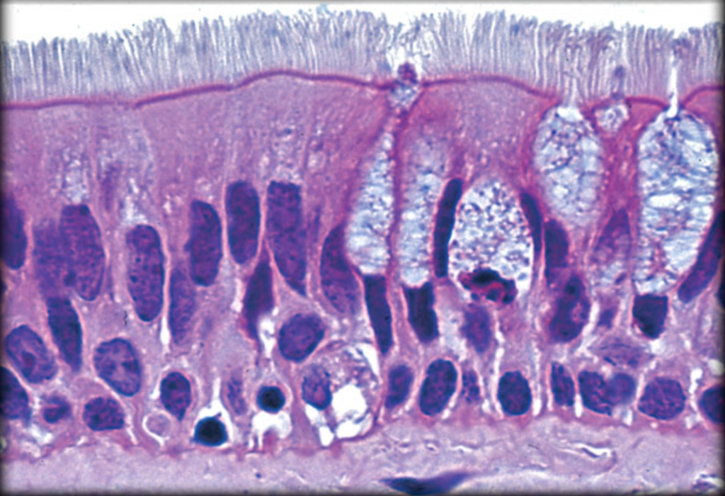 <p>What type of tissue is depicted in the image?</p>