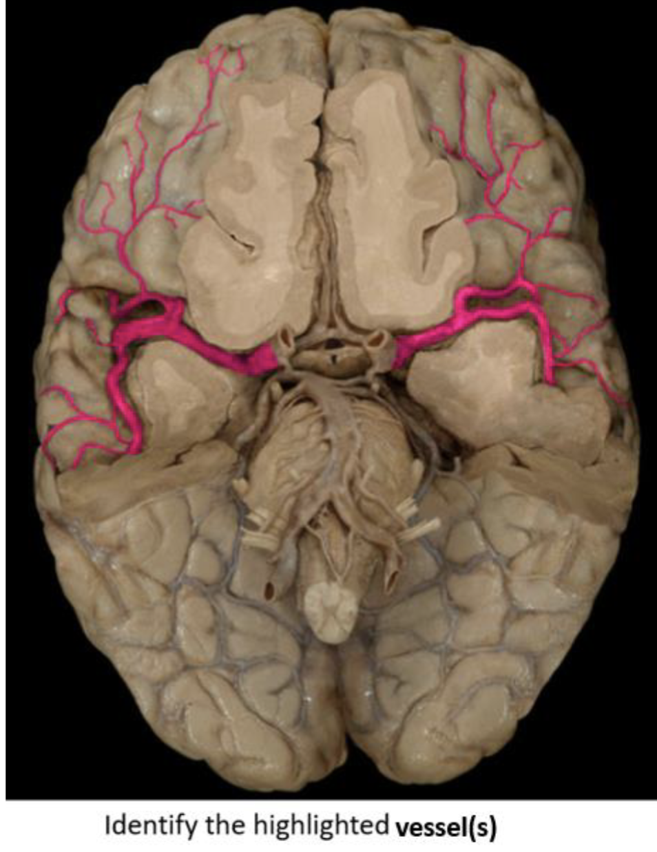 term image