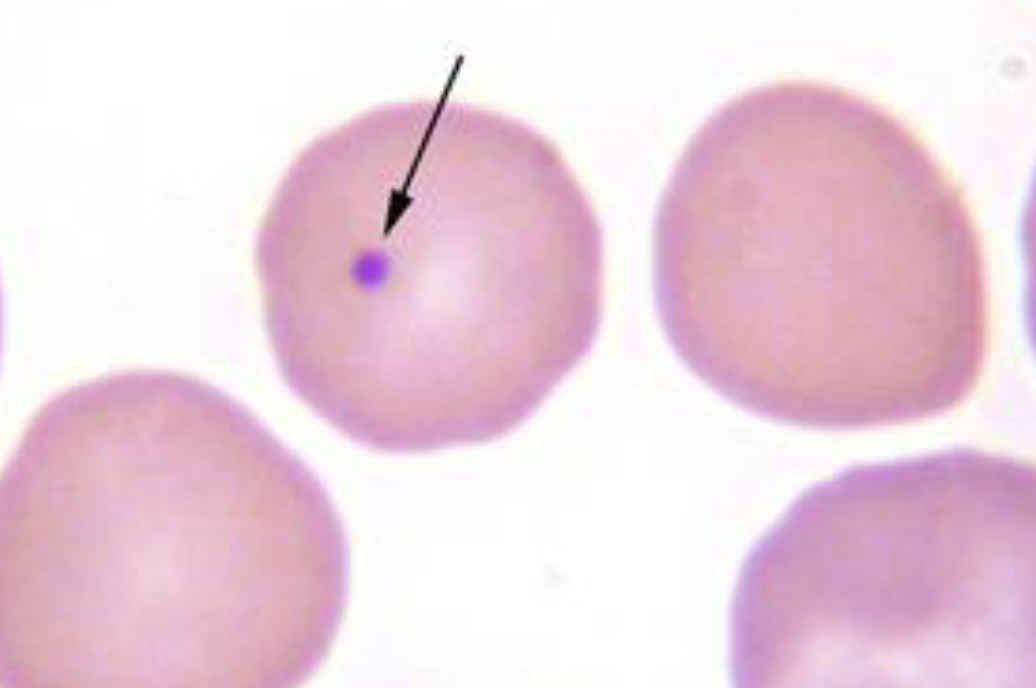 <p>Howell-Jolly Bodies </p>