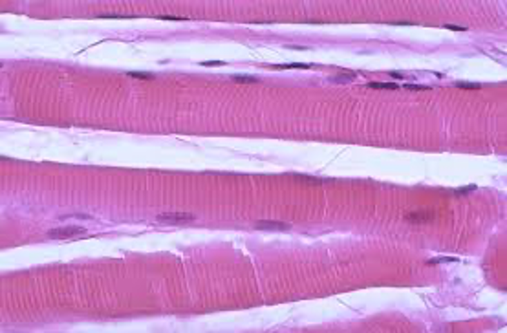 <p>voluntary muscles</p>