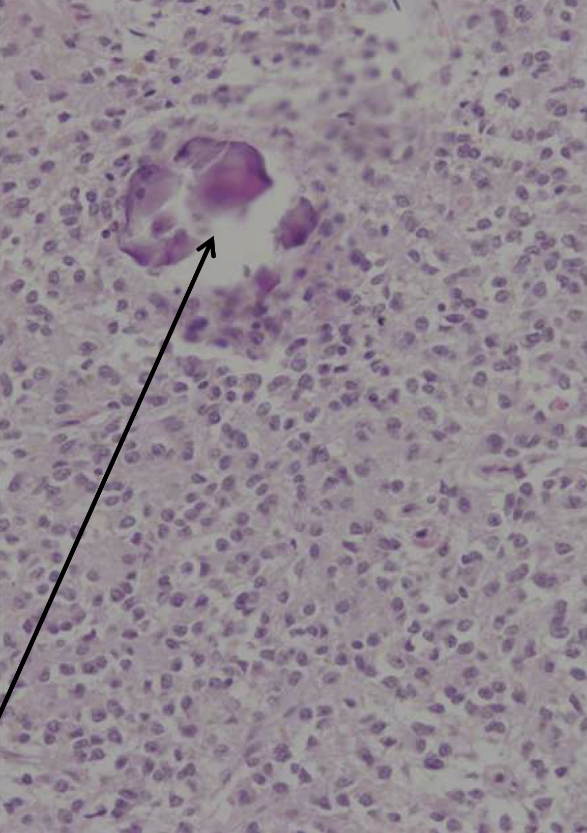 term image