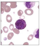 <ul><li><p>Granulocytes—<strong>basophils</strong></p><ul><li><p>Rare in blood (fewer than 1% of leukocytes)</p></li><li><p>Slightly larger than RBCs</p></li><li><p>Prominent<strong> dark-staining cytoplasmic granules</strong></p><ul><li><p>Often obscure the S-shaped nucleus</p></li></ul></li><li><p><strong>Involved in inflammatory responses and hypersensitivity reactions</strong></p><ul><li><p>Similar to mast cells</p></li></ul></li></ul></li></ul><p></p>