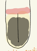 <p>SIM</p>
