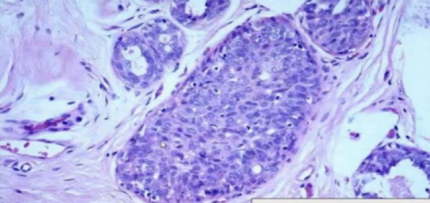 <p>What pathology? </p>