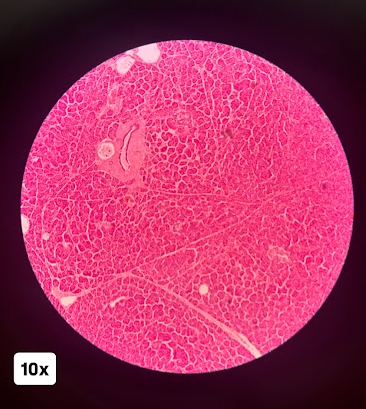 <p>This slide depicts which endocrine gland</p>