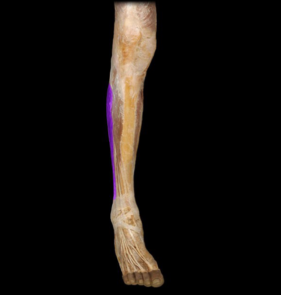 <p>What is this muscle called?</p>